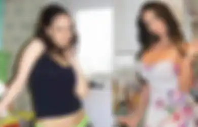 Sering Diejek Jelek, Wanita Ini Habiskan Rp4 miliar Untuk Lakukan Lebih dari 200 Prosedur Operasi Plastik