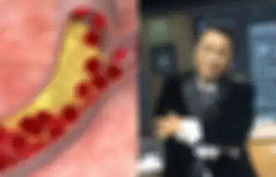 Hotman Paris Pernah Divonis Penyakit Mematikan, 5 Makanan Enak Ini Bisa Jadi Pemicunya