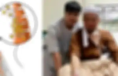 Hati-hati, Kebiasaan Memasak dengan Asap Bisa Jadi Pemicu Kanker Nasofaring Seperti yang Diidap Ustad Arifin Ilham