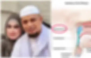 Jangan Sepelekan Mimisan, Bisa Jadi Itu Tanda Kanker Nasofaring Seperti yang Diidap Ustad Arifin Ilham