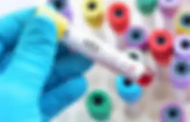 Demi Tutupi Sebuah Fakta Mengerikan, Pria Ini Tipu Dokter dan Istrinya dengan Mengaku Menderita Hepatitis C