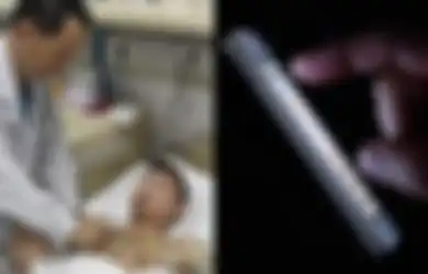 Pria 19 Tahun Ini Berakhir dengan Penyakit Mengerikan Karena Selalu Begadang Sambil Main Ponsel di Tengah Malam