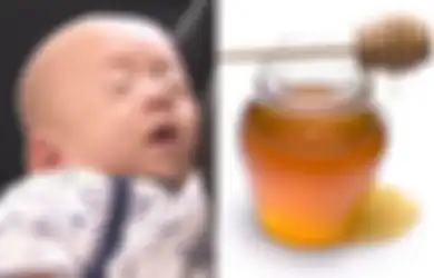 Diberi Jus yang Dicampur Madu, Bayi Berusia 6 Bulan Ini Meninggal: Ini Alasan Anak di Bawah Satu Tahun Dilarang Diberi Madu!