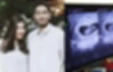 Syahnaz Sadiqah Hamil Bayi Kembar: Ini 5 Faktor yang Paling Berpengaruh dalam Mendapatkan Bayi Kembar