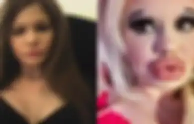 Ingin Mirip Boneka Barbie, Mahasiswa Cantik Ini Lakukan Operasi Plastik, Tapi Hasilnya Malahan Membuatnya dapat Julukan Ini