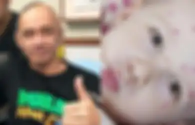 Kaleidoskop Intisari 2019: Agung Hercules Meninggal Karena Kanker Otak, Bersyukurlah Jika Anda Pernah Terkena Cacar Air, Risiko Anda Idap Kanker Otak Dipastikan Turun