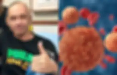 Agung Hercules Idap Kanker Otak: Dikenal Sulit Disembuhkan, Kelak Kanker Otak Justru akan Diobati dengan Virus Berbahaya Ini