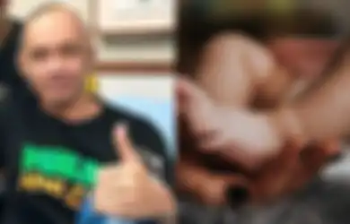Agung Hercules Idap Kanker Otak: Hati-hati, Anak Sering Kejang Bisa Jadi Penanda Awal Tumor Otak pada Anak