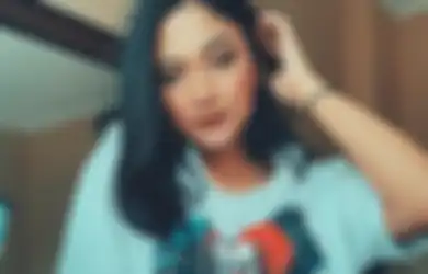 Marion Jola Punya Sindrom MPO yang Bikin Dia Dulu Sering Di-Bully