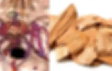 Idap Sakit Kepala Berkepanjangan Selama Lima Tahun, Pria ini Terkejut Saat Dapati Ada Potongan Kayu dengan Total Panjang 11 Cm Dalam Otaknya
