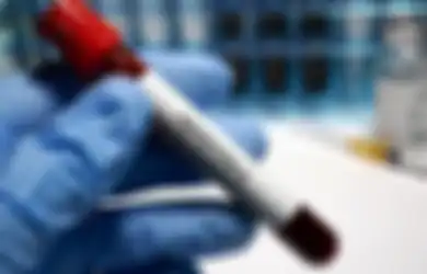 Belum Banyak yang Tahu, Di Musim Hujan  Risiko  Hepatitis A meningkat