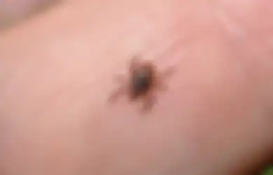 Cuma Pakai Lotion Anti Nyamuk, Siapa Sangka Bisa Hilangkan Kutu Kasur Dalam Semalam, Menyesal Baru Tahu!