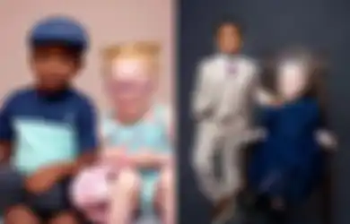 ‘Orang Tidak Percaya Anak Saya Kembar Karena Warna Kulit Mereka Berbeda’