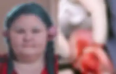 Lakukan Tindik di Bagian Tak Biasa, Telinga Wanita Ini Ditumbuhi Benjolan Daging Seberat Hampir Setengah Kilogram
