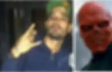 Idolakan Red Skull, Pria Ini Rela Operasi Plastik Hilangkan Hidungnya Hingga Berubah Seperti Ini