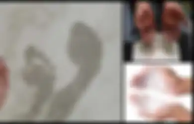 Kaki dan Tangan Anda Berkeringat? Tenang, Ini 8 Cara Mudah Mengatasinya