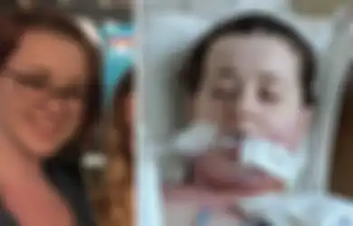 7 Giginya Dicabut untuk Pasang Behel, Nyawa Gadis Ini Hampir Melayang
