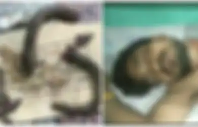 Digigit Ular Pria Ini Serang Balik Ular Itu dengan Menggigitnya, Namun Malah Berakhir Seperti Ini