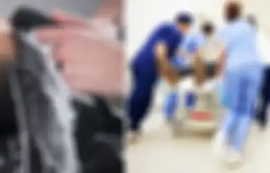 2 Hari Setelah Keramas di Salon, Pria Ini Tiba-tiba Pingsan dan Didiagnosis Terkena Stroke, Ternyata Inilah Penyebabnya, Anda Patut Waspada Juga!