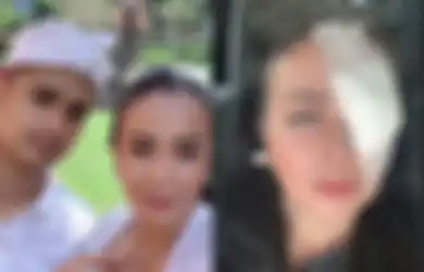 Dulu Nikah Mewah di Pulau Dewata, Kini Istri Ajun Perwira Harus Menanggung Rasa Sakit, Ada Apa?
