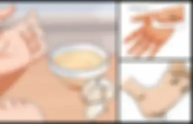5 Cara Alami Hilangkan Kutil Hingga Tak Bersisa, Termasuk dengan Bawang Putih dan Nanas, Yuk Coba!