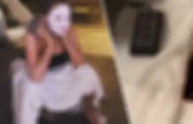 Organ Kewanitaannya Terbakar Akibat Sauna Duduk, Awalnya Wanita Ini Berniat Sembuhkan Kelainan pada Organ Intim yang Dideritanya