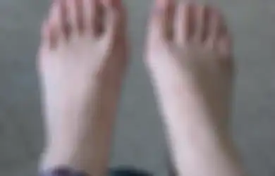 Munculnya Lesi Keunguan di Kaki Jadi Gejala Baru Terinfeksi Covid-19?