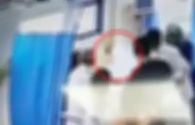 Ngeri! Kepala Pasien Wanita ini Meledak Saat Jalani Operasi, Diduga Hal Inilah yang Jadi Penyebabnya