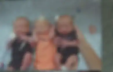 Awalnya Dikira Mengidap Batu Ginjal, Wanita ini Justru Tak Sadar Sedang Hamil dan Melahirkan Tiga Bayi Kembar