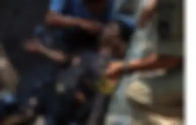 Kondisi Aiptu Erwin Alami Luka Bakar 80%, Kondisinya Mengenaskan, Jaringan Kulit dan Otot Rusak