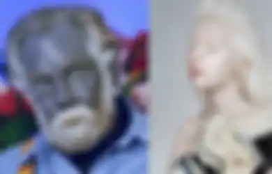 7 Kelainan Genetik Paling Unik di Dunia yang Mungkin Hanya Bisa Kita Temui Sekali Seumur Hidup