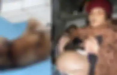 Kisah Zahra Aboutalib, Wanita yang Mengandung Hingga 46 Tahun Usia Kehamilan, Begini Kondisi Sang Bayi Saat Dikeluarkan