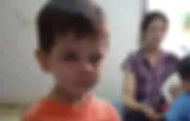 Foto-foto yang Bikin Hati Kita Miris, Bocah Ini Tetap Ceria Meski Buta dan Luka Parah Akibat Perang Saudara di Suriah. 