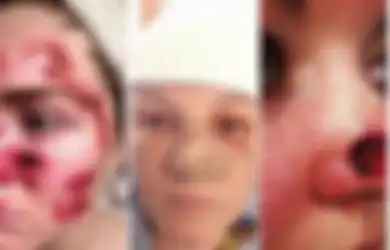 Kisah Wanita-wanita yang Mengejar Kulit Keemasan Eksotis dan Melakukan Tanning dengan Sunbed, Akhirnya Justru Memprihatinkan dengan Bekas Lubang dan Darah