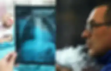Peringatan! Pneumonia Seperti yang Diidap Maurizio Sarri Juga Bisa Diidap oleh Anak dari Ayah Perokok