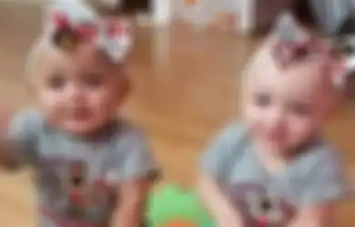 ‘Saya Tidak Melihat Ada Perbedaan Warna,’ Kata Ibu Bayi Kembar yang Lahir dengan Ras dan Warna Kulit yang Berbeda