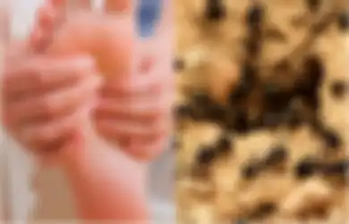 Dari Cantengan hingga Kesemutan, Ini 6 Penyakit yang 'Hanya Ada' di Indonesia