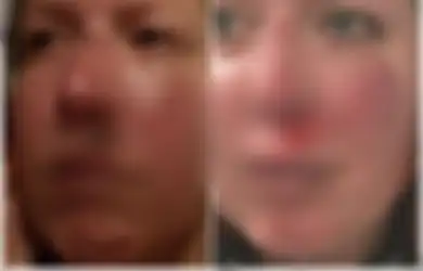 Tolak Tukar Pemberian Sumbangan dengan Tidur Bersama, Relawan Amal Ini Diserang 'Calon Donatur'