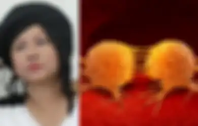 Sebelum Meninggal, Ria Irawan Idap Kanker Kelenjar Getah Bening: Benjolan di Leher atau di Belakang Telinga Bisa Jadi Penyebabnya