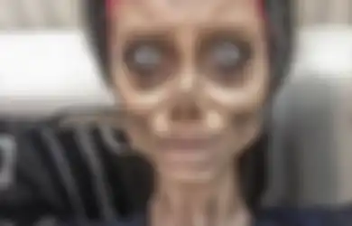 Lakukan 50 Kali Operasi Plastik demi Mirip Angelina Jolie, Wajah Gadis Ini Justru Mengerikan, Nasibnya Kini Pun Tak Kalah Memprihatinkan