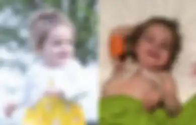 Baru Berusia 2 Tahun, Bocah Cantik Ini Terserang Penyakit Misterius, Hanya Bisa Hidup dengan Menjadi 'Vampir'