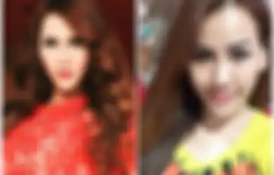 Sudah Rogoh Miliaran Rupiah, Pedangdut Molek Ini Wajahnya Lumpuh Gara-Gara Operasi Plastik!