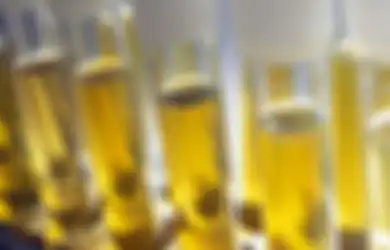 Coba Perhatikan Perubahan Air Kencing Anda, Waspada Jika Berbau Menyengat, Bisa Jadi Penyakit Berbahaya Sedang Menggerogoti