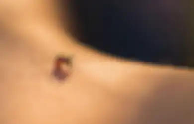 Beginilah Jadinya Jika Nyamuk  Menghisap Darah Penderita HIV Lalu Menghisap Darah Orang Normal, Benarkah Virus Langsung Menular?
