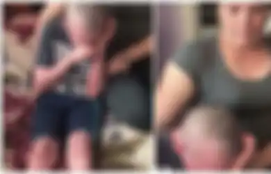 'Aku Ingin Mati Saja,' Kata Bocah yang Derita Penyakit Kulit Langka hingga Dokter Menyerah Menanganinya
