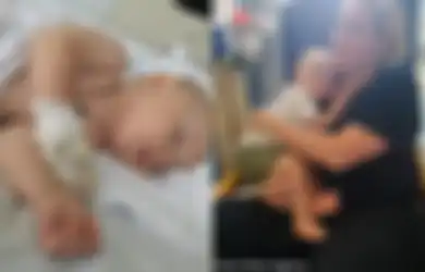 Tidak Nafsu Makan dan Demam pada Bayi Ini Dikira Karena Tumbuh Gigi, Rupanya Ia Mengidap Suatu Penyakit Sampai Harus Dioperasi