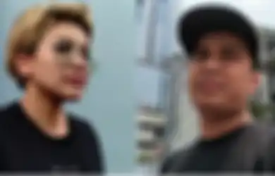 Makin Panas, Nikita Mirzani Bongkar Hubungannya dengan Billy Syahputra yang Rusak Lantaran Hal Ini: Nah yang Sekarang pun Sama