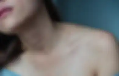 Jelang Peringatan 'Hari Lupus Sedunia', Kenali Gejala dan Ciri-ciri Penyakit Lupus yang Sering Menyerang Kaum Perempuan pada Masa Subur