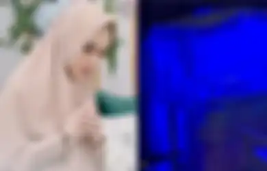 Bayi Kartika Putri Terkena Penyakit Kuning, Apa Penyebab Penyakit Kuning pada Bayi Baru Lahir Ini dan Bisakah Dicegah?