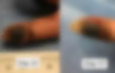 Seorang Pekerja Lab Tak Sengaja Menusuk Dirinya Dengan Virus, Tapi Dia Tak Tau Virus Jenis Apa yang Menginfeksinya